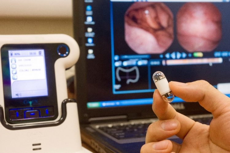 Kapsulas endoskopija