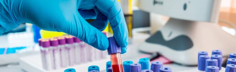 Service-dog-bloodwork-1800×550