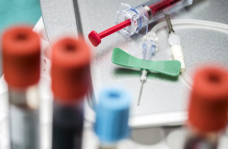 butterfly-needle-on-a-laboratory-table-next-to-6SPZB37-min