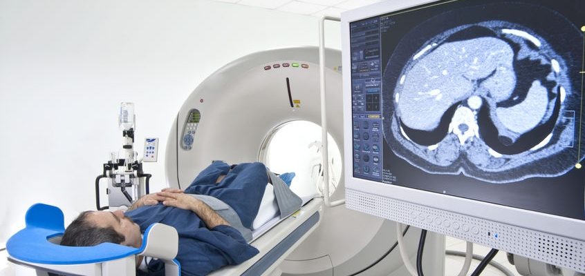 mri_man_image37257258_M mri_man_image37257258_M